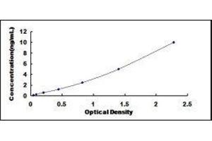 ELISA image for Transient Receptor Potential Cation Channel, Subfamily M, Member 1 (TRPM1) ELISA Kit (ABIN418482)
