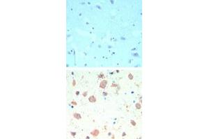 Image no. 1 for anti-K(lysine) Acetyltransferase 5 (KAT5) (AA 480-530) antibody (ABIN960242)