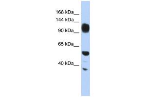 WB Suggested Anti-WDHD1 Antibody Titration: 0. (WDHD1 anticorps  (Middle Region))