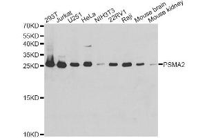 Western blot analysis of extracts of various cell lines, using PSMA2 antibody. (PSMA2 anticorps)