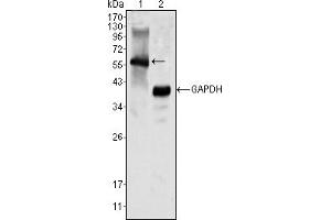 Image no. 2 for anti-Megakaryocyte-Associated tyrosine Kinase (MATK) antibody (ABIN466781) (MATK anticorps)