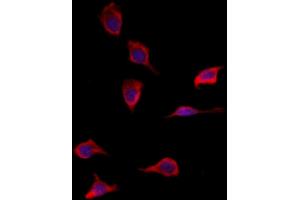 ABIN6265218 and ABIN6277933 staining HepG2 by IF/ICC. (SOD3 anticorps  (Internal Region))