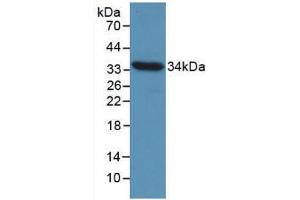 Western blot analysis of recombinant Chicken CCND1. (Cyclin D1 anticorps  (AA 1-292))