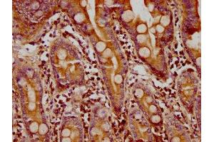 anti-Formin 1 (FMN1) (AA 354-487) antibody