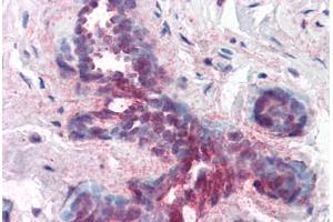 Human Breast (formalin-fixed, paraffin-embedded) stained with PDCD4 antibody ABIN214444 at 1. (PDCD4 anticorps  (pSer457))