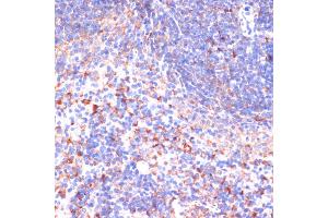 Immunohistochemistry of paraffin-embedded mouse spleen using VHL antibody (ABIN3020967, ABIN3020968, ABIN3020969 and ABIN6213828) at dilution of 1:200 (40x lens).