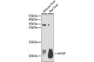 Western blot analysis of extracts of various cell lines, using AHSP antibody (ABIN6131912, ABIN6136672, ABIN6136673 and ABIN6222122) at 1:1000 dilution. (aHSP anticorps  (AA 1-102))