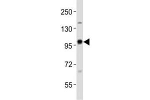 Western blot testing of EZH2 antibody at 1:1000 dilution + rat C6 lysate; Predicted size : 85-95 kDa.