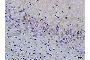 Formalin-fixed and paraffin embedded rat kidney tissue labeled with Anti phospho-MAP3K9+MAP3K10(Thr312+Thr266) Polyclonal Antibody, Unconjugated (ABIN872294) at 1:200 followed by conjugation to the secondary antibody and DAB staining (MAP3K9 anticorps  (pThr312))