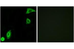 Immunofluorescence analysis of A549 cells, using RPS20 Antibody. (RPS20 anticorps  (AA 31-80))