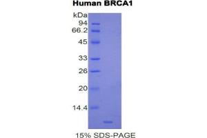 SDS-PAGE (SDS) image for Breast Cancer 1 (BRCA1) (AA 19-83) protein (His tag) (ABIN1877581)