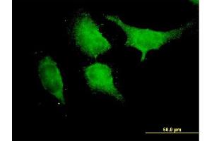Immunofluorescence of purified MaxPab antibody to TRAF6 on HeLa cell.
