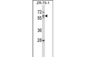 IC Antibody (Center) (ABIN657631 and ABIN2846627) western blot analysis in ZR-75-1 cell line lysates (35 μg/lane). (ICAM-3/CD50 anticorps  (AA 282-310))