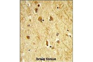Formalin-fixed and paraffin-embedded human brain tissue reacted with ADTS18 Antibody (C-term), which was peroxidase-conjugated to the secondary antibody, followed by DAB staining.