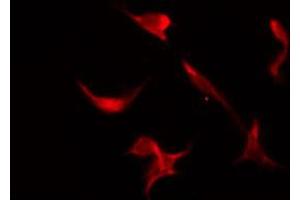 ABIN6266451 staining HeLa by IF/ICC.