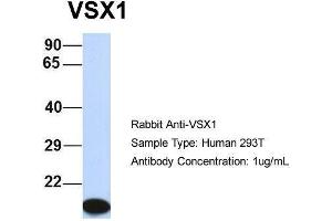 Host:  Rabbit  Target Name:  VSX1  Sample Type:  Human 293T  Antibody Dilution:  1. (VSX1 anticorps  (Middle Region))