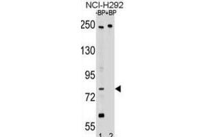 Western Blotting (WB) image for anti-Adaptor Protein, phosphotyrosine Interaction, PH Domain and Leucine Zipper Containing 2 (APPL2) antibody (ABIN2999473) (APPL2 anticorps)
