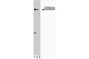 Western blot analysis of eIF-4gamma on EB-1 lysate.