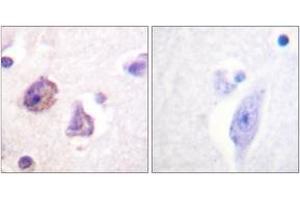 Immunohistochemistry analysis of paraffin-embedded human brain, using FAK (Phospho-Tyr576) Antibody. (FAK anticorps  (pTyr576))