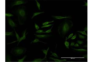 Immunofluorescence of monoclonal antibody to PCNA on HeLa cell. (PCNA anticorps  (AA 78-177))
