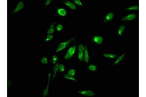 Immunofluorescence staining of Hela cells with ABIN7139270 at 1:2. (HIST1H2AG anticorps  (2meArg11))