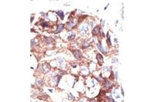 Image no. 2 for anti-Ubiquilin 1 (UBQLN1) (N-Term) antibody (ABIN357617) (Ubiquilin 1 anticorps  (N-Term))