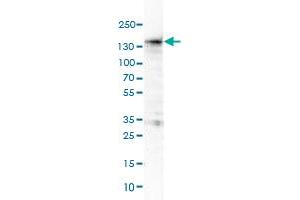Western Blot (Cell lysate) analysis of HL-60 cell lysate. (MKL1 anticorps)