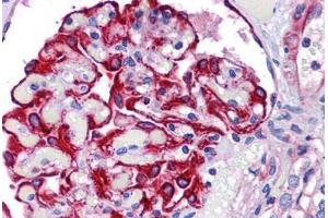 Human Kidney: Formalin-Fixed, Paraffin-Embedded (FFPE)