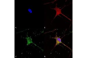 Immunocytochemistry/Immunofluorescence analysis using Mouse Anti-SUR1 Monoclonal Antibody, Clone S289-16 (ABIN1027723).