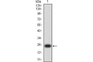 Western blot analysis using S100B mAb against human S100B (AA: 1-92) recombinant protein. (S100B anticorps  (AA 1-92))
