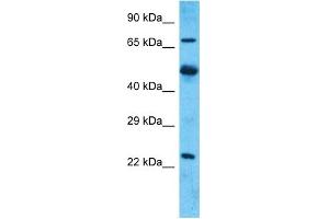 Host:  Rabbit  Target Name:  MARCH7  Sample Type:  Uterus Tumor lysates  Antibody Dilution:  1.