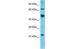 Host:  Rabbit  Target Name:  MARCH7  Sample Type:  Uterus Tumor lysates  Antibody Dilution:  1. (MARCH7 anticorps  (N-Term))