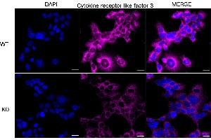 Immunocytochemical staining of HeLa cells using Cytokine receptor like factor 3 antibody (ABIN7798262), 1:1,000), Top panel: wild-type (WT), Bottom panal: Cytokine receptor like factor 3 shRNA knockdown (KD). (CRLF3 anticorps)