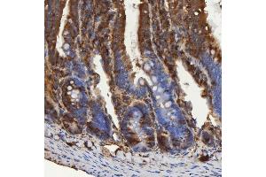 IHC analysis of SEC31A using anti-SEC31A antibody (ABIN7599630).