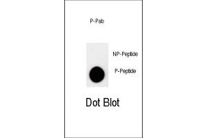 Dot Blot (DB) image for anti-Cyclin-Dependent Kinase Inhibitor 1B (p27, Kip1) (CDKN1B) (pThr157) antibody (ABIN2970965)