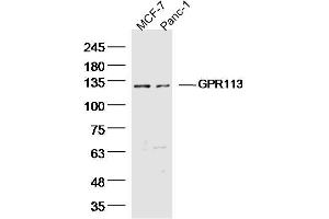 Lane 1: MCF-7 Cell lysates, Lane 2: Panc-1 Cell lysates, probed with GPR113 Polyclonal Antibody, unconjugated  at 1:300 overnight at 4°C followed by a conjugated secondary antibody for 60 minutes at 37°C. (GPR113 anticorps  (AA 1-100))
