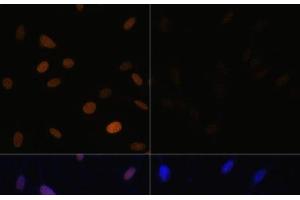 Immunofluorescence analysis of NIH/3T3 cells using Acetyl-Histone H4-K16 Polyclonal Antibody at dilution of 1:100.