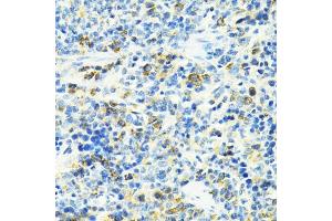 Immunohistochemistry of paraffin-embedded rat spleen using SLC25 antibody (ABIN6132660, ABIN6147903, ABIN6147904 and ABIN6224187) at dilution of 1:100 (40x lens).