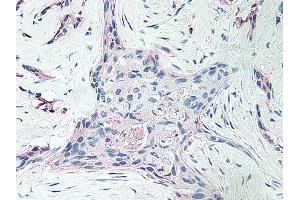 Image no. 1 for anti-Platelet Factor 4 (PF4) antibody (ABIN465152) (PF4 anticorps)