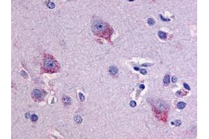 Anti-LPHN1 antibody IHC of human brain, neurons and glia. (Latrophilin 1 anticorps  (C-Term))
