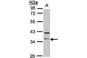 WB Image Sample(30 ug whole cell lysate) A:Raji , 10% SDS PAGE antibody diluted at 1:500
