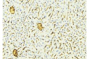 ABIN6275819 at 1/100 staining Mouse liver tissue by IHC-P.
