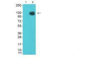 Western blot analysis of extracts from Hela cells (Lane 2), using HDAC4 (Ab-632) antiobdy.