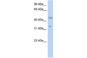 Western Blotting (WB) image for anti-Epidermal Retinal Dehydrogenase 2 (RDHE2) antibody (ABIN2459555) (SDR16C5 anticorps)