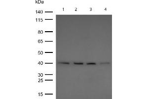 All lanes : BMP6 Rabbit mAb at 1/1k dilution Lane 1 : Mouse Lung lysates Lane 2 : Rat Brain lysates Lane 2 : Rat Kidney lysates Lane 3 : Rat Lung lysates Lysates/proteins at 20 μg per lane.