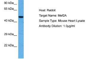 Host:  Mouse  Target Name:  MEF2A  Sample Tissue:  Mouse Heart  Antibody Dilution:  1ug/ml (MEF2A anticorps  (N-Term))