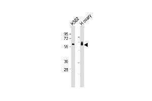 All lanes : Anti-C17orf80 Antibody (Center) at 1:1000-1:2000 dilution Lane 1: K562 whole cell lysates Lane 2: human ovary lysates Lysates/proteins at 20 μg per lane. (HLC8 anticorps  (AA 264-696))