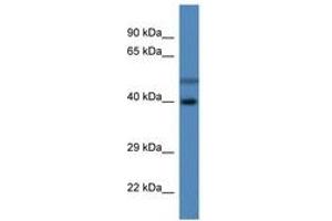 Image no. 1 for anti-Hydroxysteroid Dehydrogenase Like 1 (HSDL1) (C-Term) antibody (ABIN6746873) (HSDL1 anticorps  (C-Term))