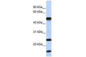 UBE2L6 antibody used at 1 ug/ml to detect target protein. (UBE2L6 anticorps  (N-Term))