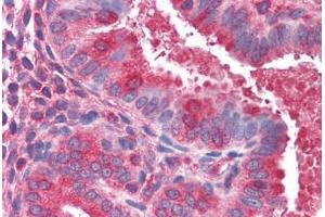 Human Uterus (formalin-fixed, paraffin-embedded) stained with ACTR1B antibody ABIN351475 at 3. (ACTR1B anticorps  (AA 363-375))